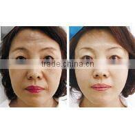 The factory price Photon Skin Rejuvenation cavitation gel vacuum rf for salon use