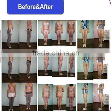 Vacuum Suction Cellulite Reduction Beauty Equipment