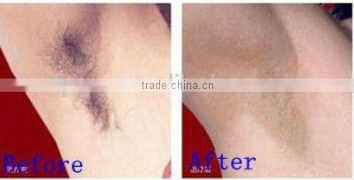 New style hotsell mini home ipl hair removal machine