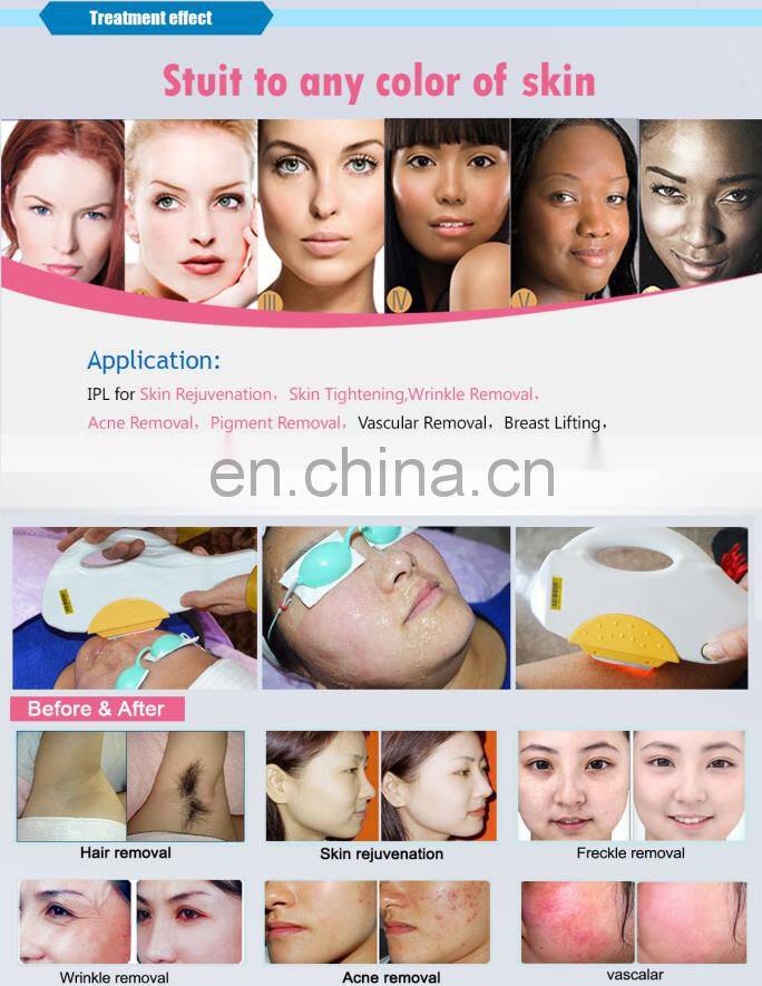 Hair Removal hair removel SHR 2 in 1 OPT SHR Professional Laser Hair Removal Brown