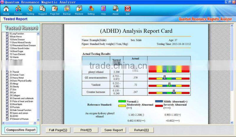 2016 Egypt veins Golden Color Quantum Resonance Magnetic Analyzer