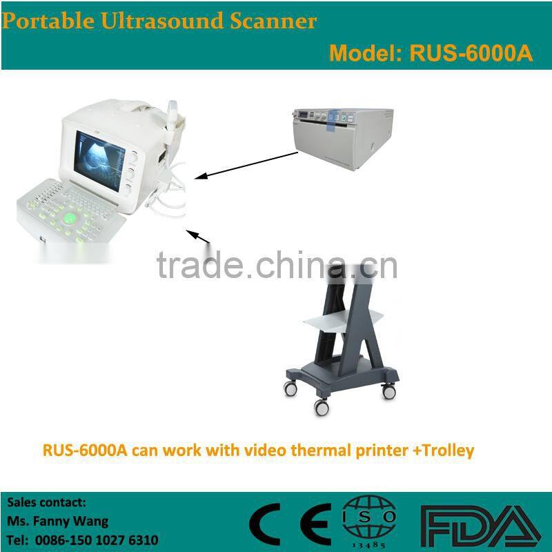 Factory price!!CE approved 3.5Mhz multi-frequency convex probe Portable B-Mode Ultrasound Scanner system