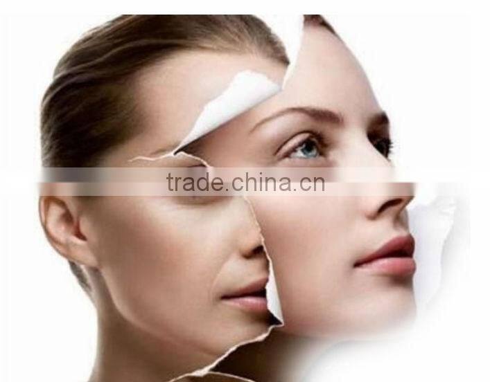 portable 808nm laser hair removal machine price in india