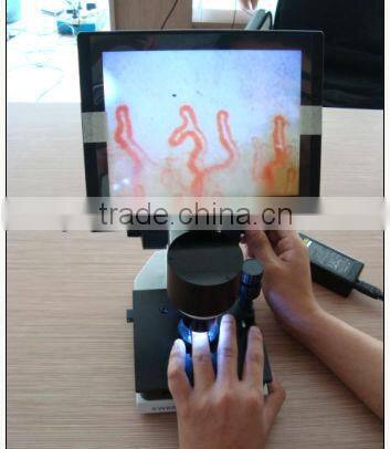 nail fold microcirculation microscope capillaroscope video microcirculation microscope capillary microscope
