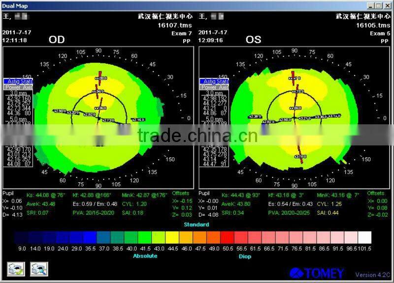 MCT Hard lens For low myopia/MCT lenses/no operation treat myopia,make your eyes normal