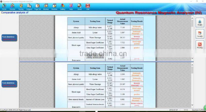 High-tech 4th generation 45 reports quantum bio resonance analyzer