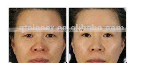 2014 hot sale Portable Renovation and skin lifting Machine ultrasonic cavitation rf vacuum with CE approve