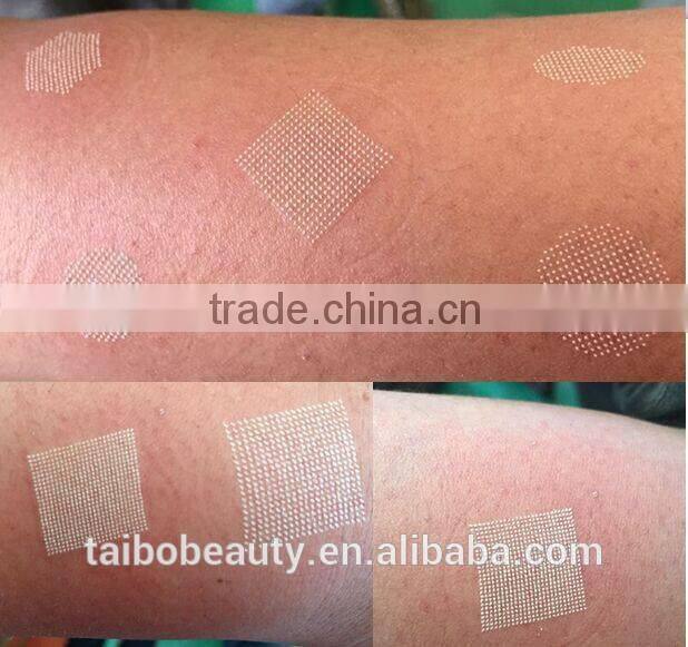 USA RF tube 10600nm fractional laser CO2 skin care Beauty machine / co2 laser vaginal tightening rejuvenation treatment