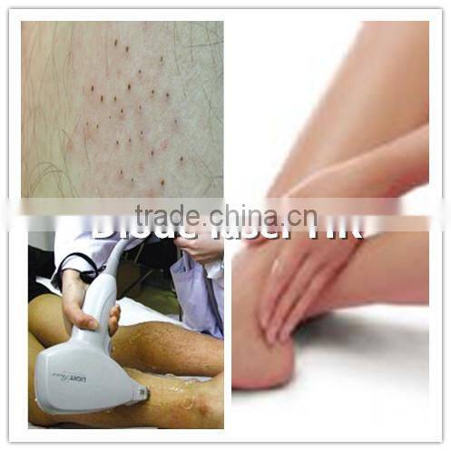 Professional Cosmetic Elight Skin Rejuvenation plus 808nm Diode Laser beauty equipment