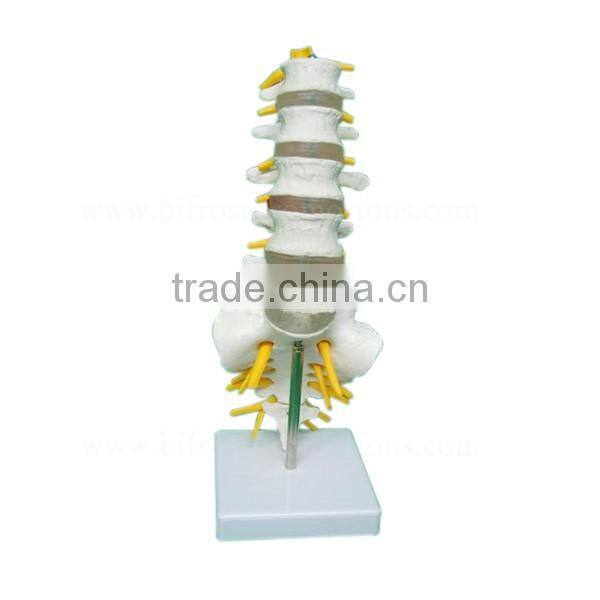 Life-size 5 Pcs Anatomical Lumbar Vertebra Model