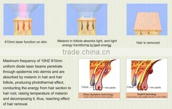 Newly designed most advanced professional vertical 808nm diode laser hair removal skin spa medical device