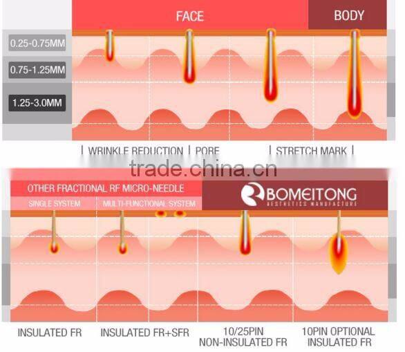 Salon use 5MHZ RF skin tightening face lifting beauty machine monopolar rf machine