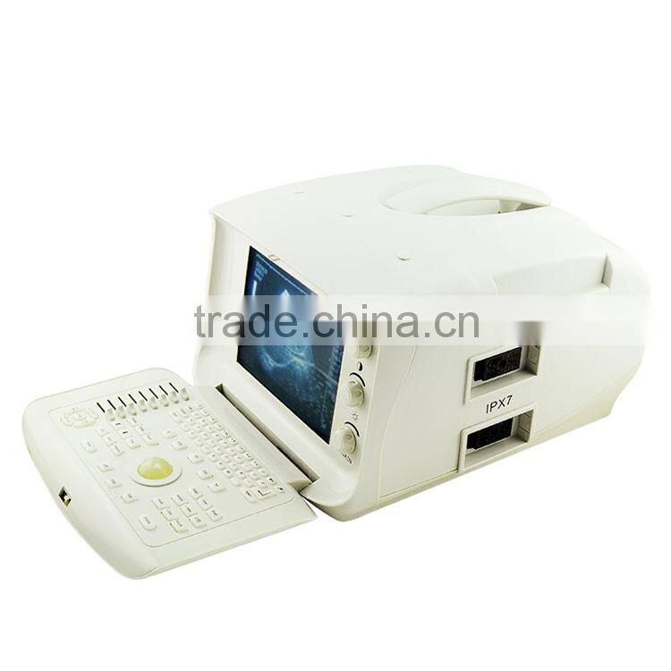 Factory price!!CE approved 3.5Mhz multi-frequency convex probe Portable B-Mode Ultrasound Scanner system