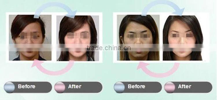 Hot Sale micro magic skin tightning machine