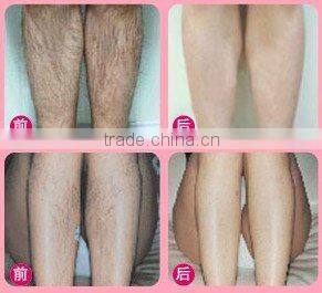 . Economic Portable IPL Hair removal Beauty Machine