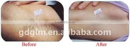 IPL+RF+Laser tattoo removal+ E-light with medical CE