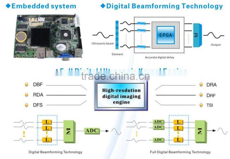 CE approved Laptop PC Ultrasound Scanner /Ultrasonic scanner with 3.5Mhz multi-frequency convex probe RUS-9000E2
