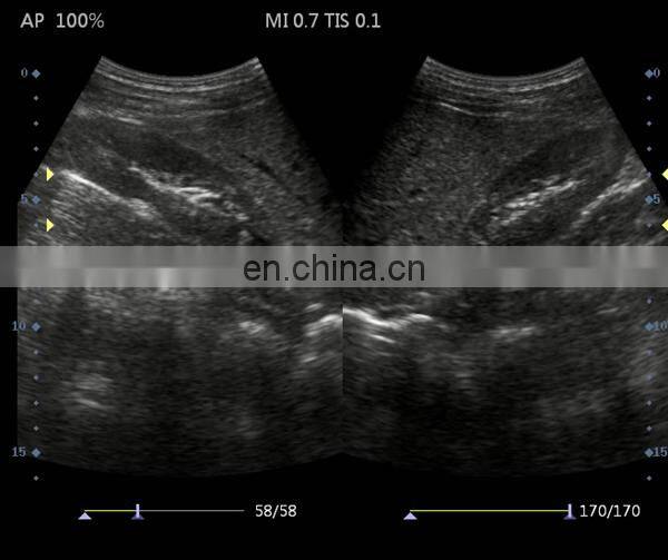 HC-A006B Full digital 15 inch Laptop Ultrasound machine with competitive price(ARM based)