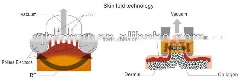 cavitating slimming laser machine