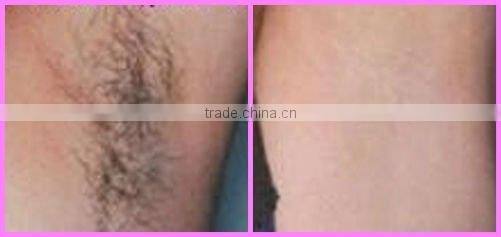 E08 multi-functional ipl machine