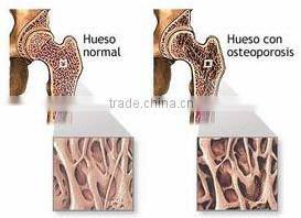 BNP Supply 100% Natural Resveratrol Capsules/Giant Knotweed Extract Capsules