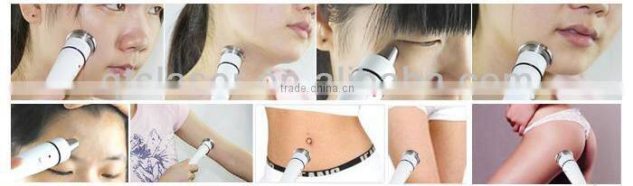 advanced radio frequency technology to provide optimal skin contraction in the deep layers of your skin