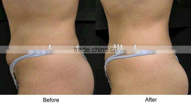 Jimpness Beauty Fat Loss Infrared Fat Burning Massager F019