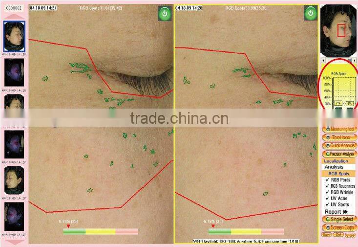 portable skin analyze machine/uv skin analyzer/skin analyzer