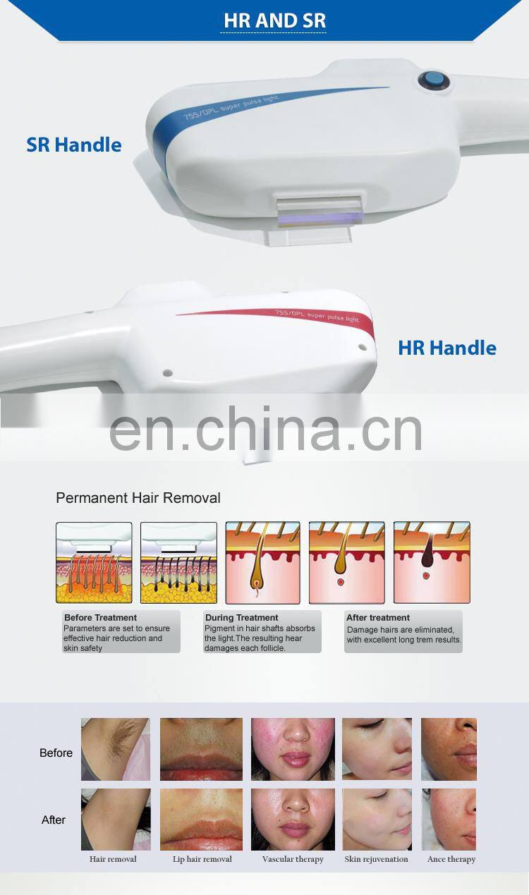Powerful fast hair removal machine with double DPL handle