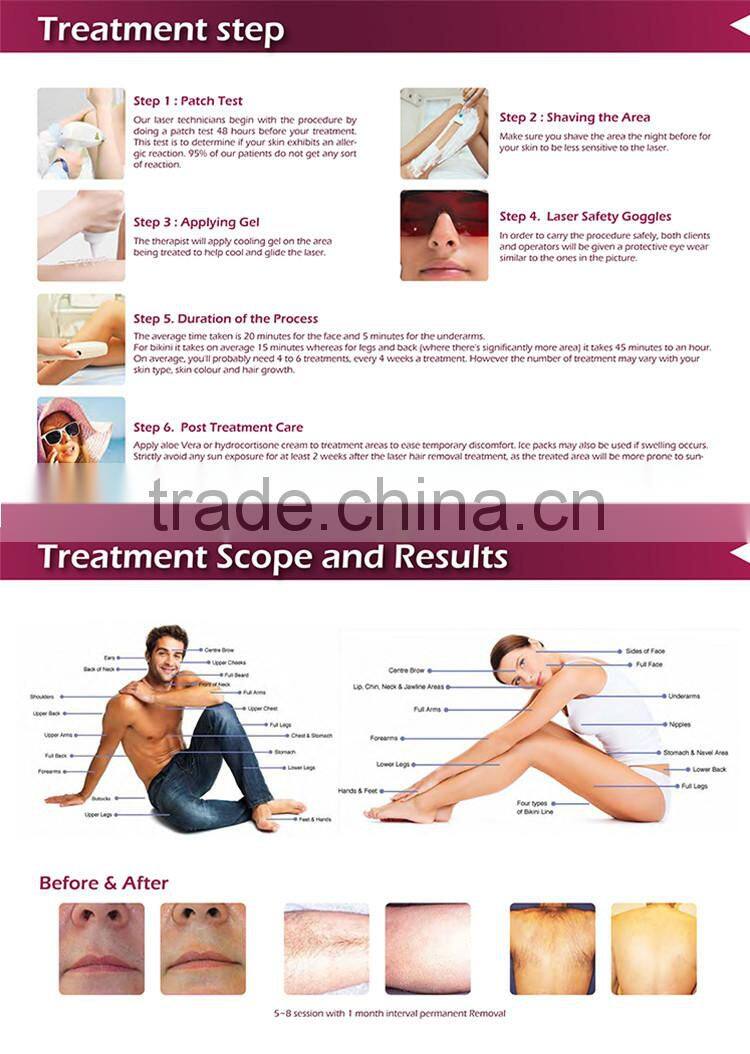 Most popular beauty equipment medical CE & FDA approved face laser machine bikini hair removal