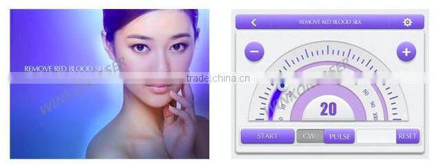 spider vein laser / spider vein removal home / varicose veins