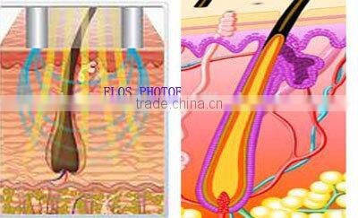 530nm 640nm two handles ipl photo rejuvenation machine