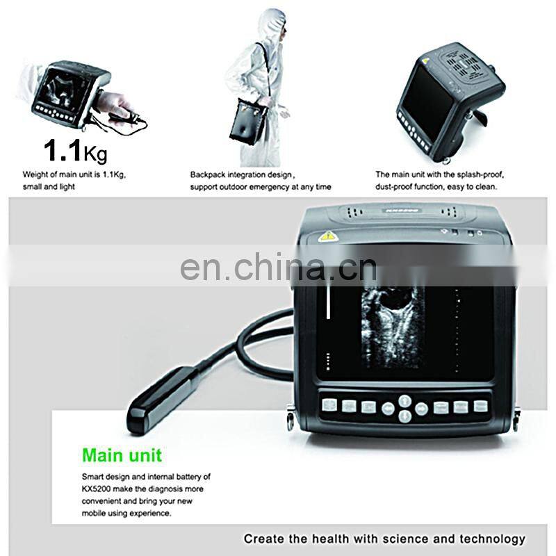 VET-A020V Livestock Digital Vet ultrasound scanner/Portable Cattle Ultrasound Machine