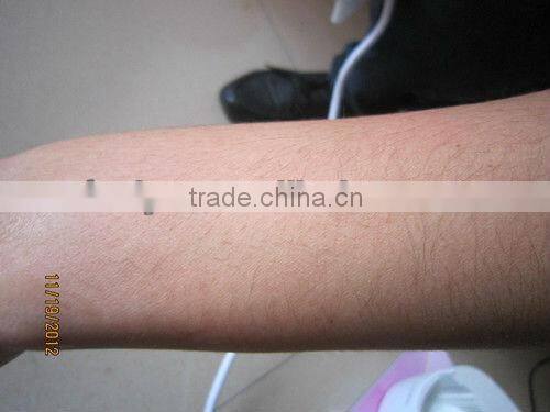 IPL-10 Used ipl handle machines with CE approval