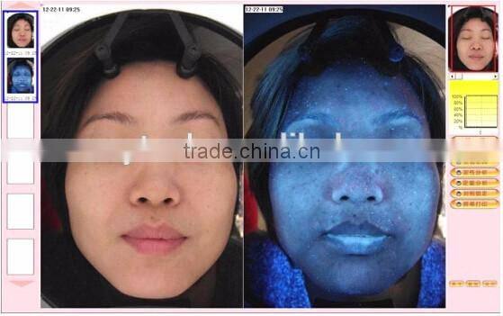 Professional high definition 3d skin analyzer machine / skin scanner analyzer / skin analyzer magnifier machine A10