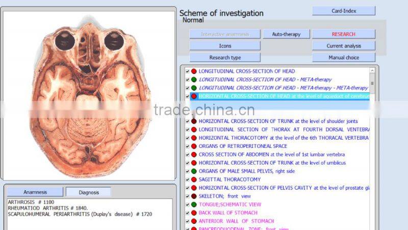 2016 Hot sell 9D NLS quantum magnetic resonance health body analyzer from Phenitech