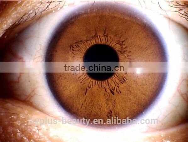 AYJ-J013(CE)Effective 5.0 high resolustion skin /hair/Iris analysis equipment