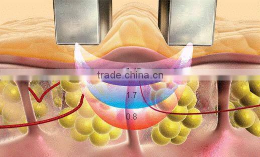 cheapest Israel viora reaction reaction beauty machine