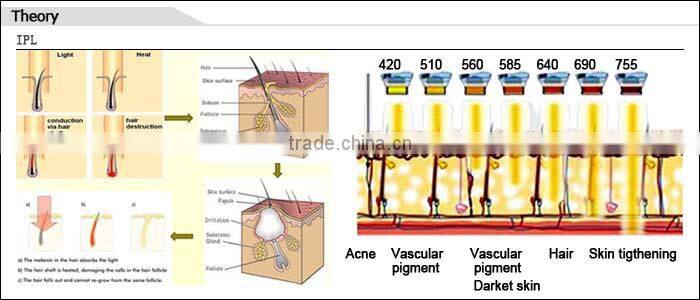 2014 CE Approved 3 years warranty hair removal machines for salon use