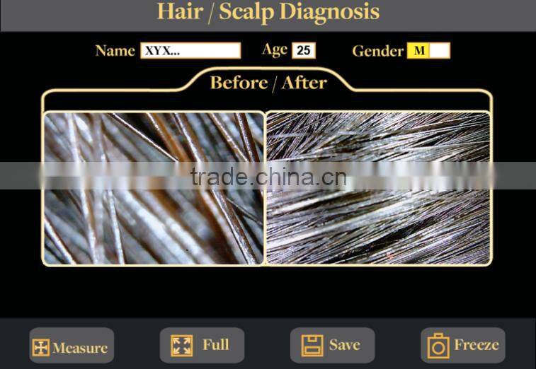 hair analysis machine in Skin Analyzer hair analysis equipment