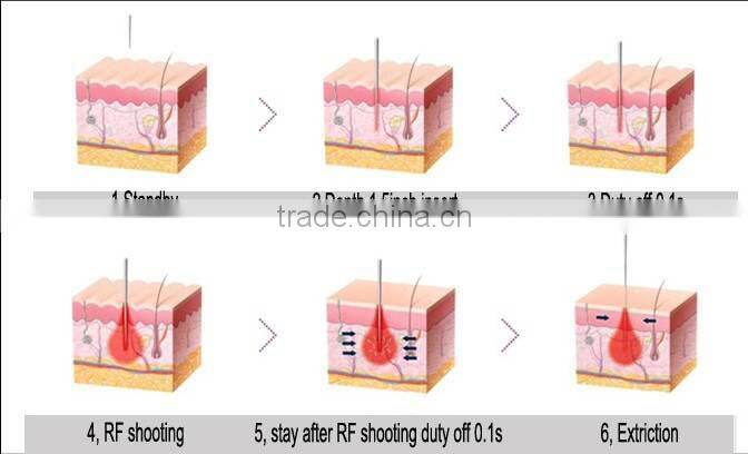 2015 desktop Fractional RF beauty machine