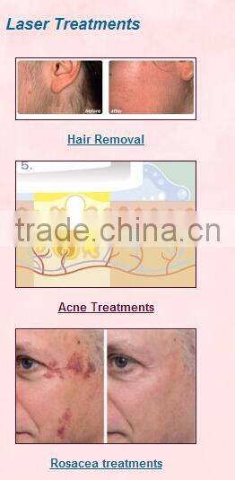 Professional Cosmetic Elight Skin Rejuvenation plus 808nm Diode Laser beauty equipment