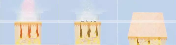 GSD pain-free ipl multifunctional machine ce rohs certification beauty equipment