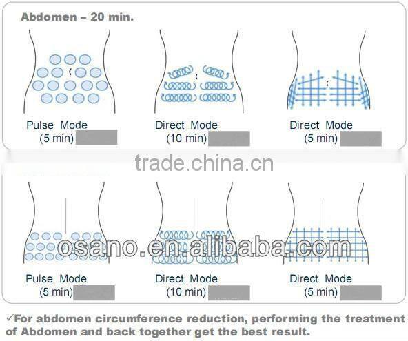 osano portable rf slimming machine - rf radio frequency ultrasound cavitation machine for sale lower price !