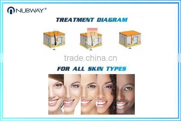 Popular!!! Guarantee 20 million flashes diode laser hair removal 808nm ce approved