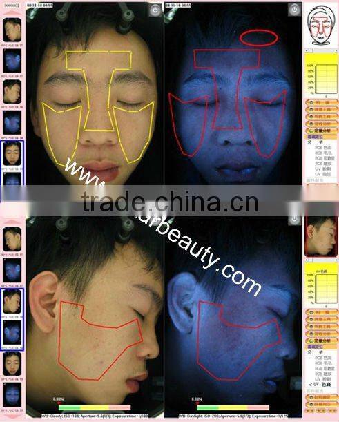 Factory wholesale magic mirror system skin testing equipment OB-SA 03