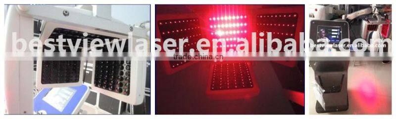 2017 Top high power 670 nm laser diode treatment hair loss BM-666
