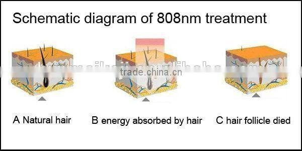 Painless 808nm Diode Laser Hair Removal Machine , diode laser Equipment