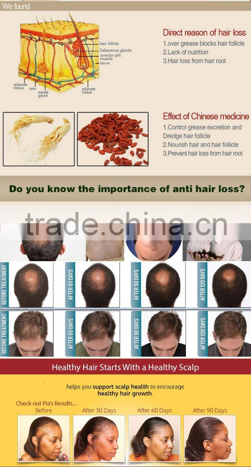 Sunburst Plus Hair Growth Lotion NEW UPGRADE 100ml