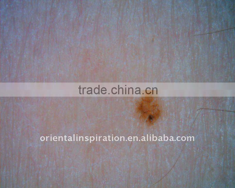 Best USB microscope for skin and hair, hair microscopes, skin usb microscope, polarizer USB microscope, filter microscope